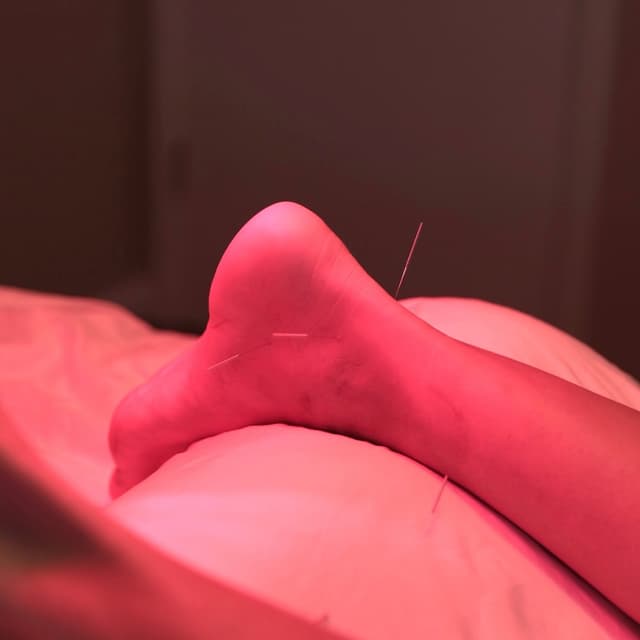 5-Session Hormone Reset at The Dermal Formula in San Mateo, CA