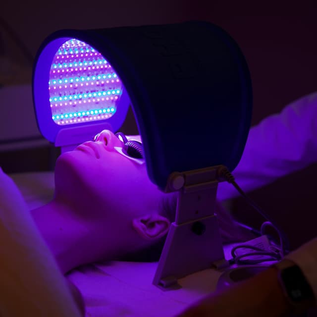 3-Month Acne Reset Program at The Dermal Formula in San Mateo, CA